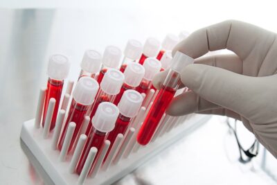 У нас Вы можете сделать общий анализ крови на 47 параметров!